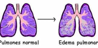 edemaagudo