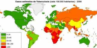 tuberculosis