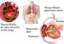 Fibrosis