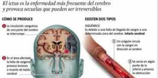 ictus