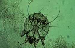 la-escabiosis