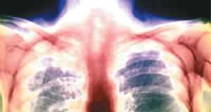 Los-pulmones