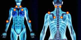 Algunos-remedios-naturales-utiles-en-casos-de-Fibromialgia