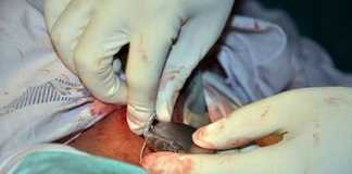 Una-posible-nueva-opcion-de-marcapasos-implantables