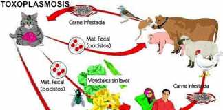 toxoplasmosis