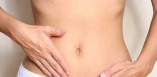 candidiasis