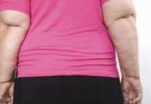 Las mujeres con sobrepeso y obesidad tienen un mayor riesgo de artritis reumatoide Las-mujeres-con-sobrepeso
