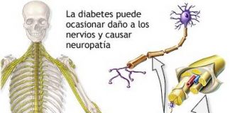Prevenir-la-neuropatia-diabetica