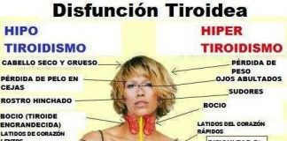 tiroides