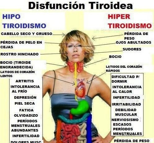 Diferencias entre hipertiroidismo e hipotiroidismo tiroides