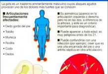 acidourico1