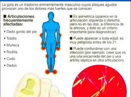 acidourico1