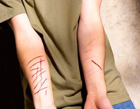Adolescentes que se cortan y lesionan el cuerpo adolescentes-lesiones