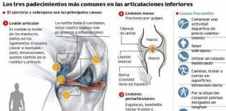 artrosis