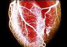 corazon-obeso