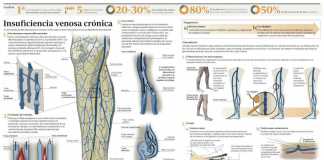 2011_varices