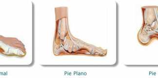 pies