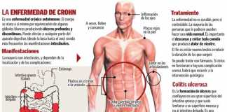 Crohn