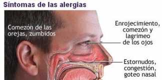 alergias