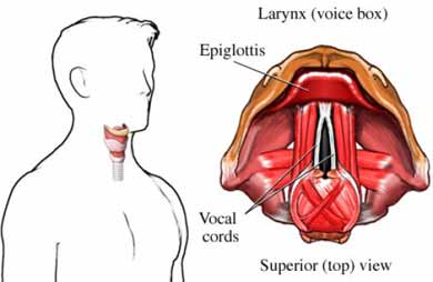 Problemas de la voz, laringitis y afonía laringitis