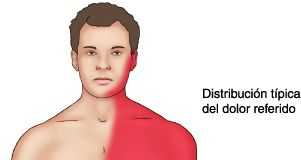anginapecho