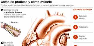 infarto