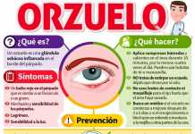 Cómo prevenir el orzuelo en el ojo orzuelo