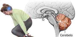 ataxia