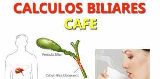 piedras-biliares