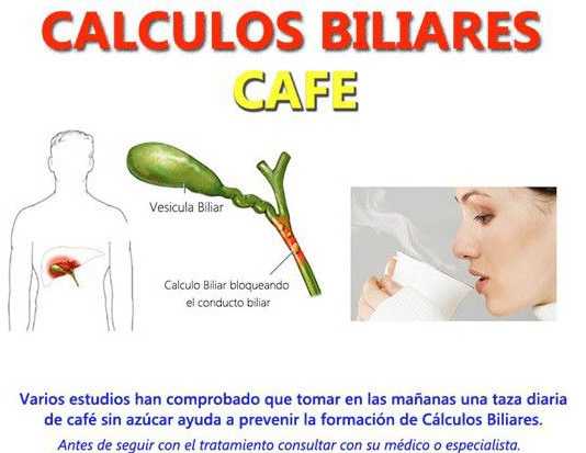piedras-biliares