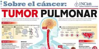 cancerpulmon
