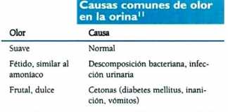 orina-olores