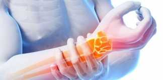 tendinitis