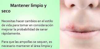consejosherpes