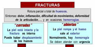 fracturas