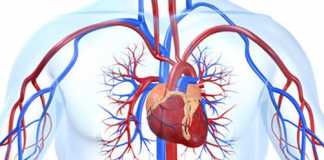 infartos