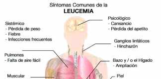 leucemia