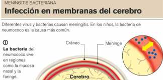 meninges