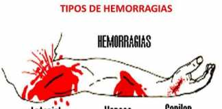 sangre