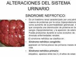 sindrome-nefrotico