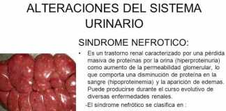 sindrome-nefrotico