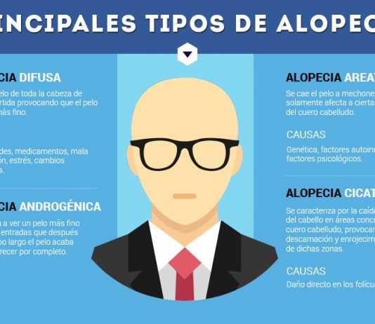 alopecia-difusa