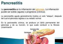 pancreatitis