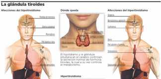 tiroides1
