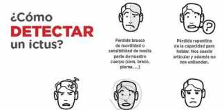 detectarictus