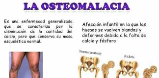 osteomalacia