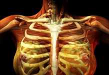 Costocondritis