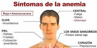 anemia-sintomas
