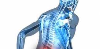 dolor-sacrolumbar