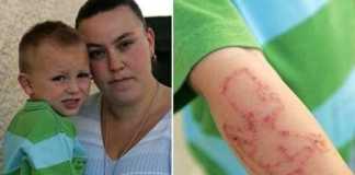 alergia-tatuajes-henna